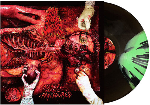 PREORDER: 200 STAB WOUNDS- MANUAL MANIC PROCEDURES (LP)